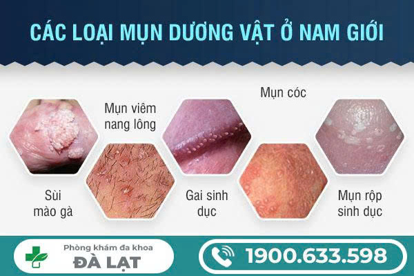 Hình ảnh minh họa